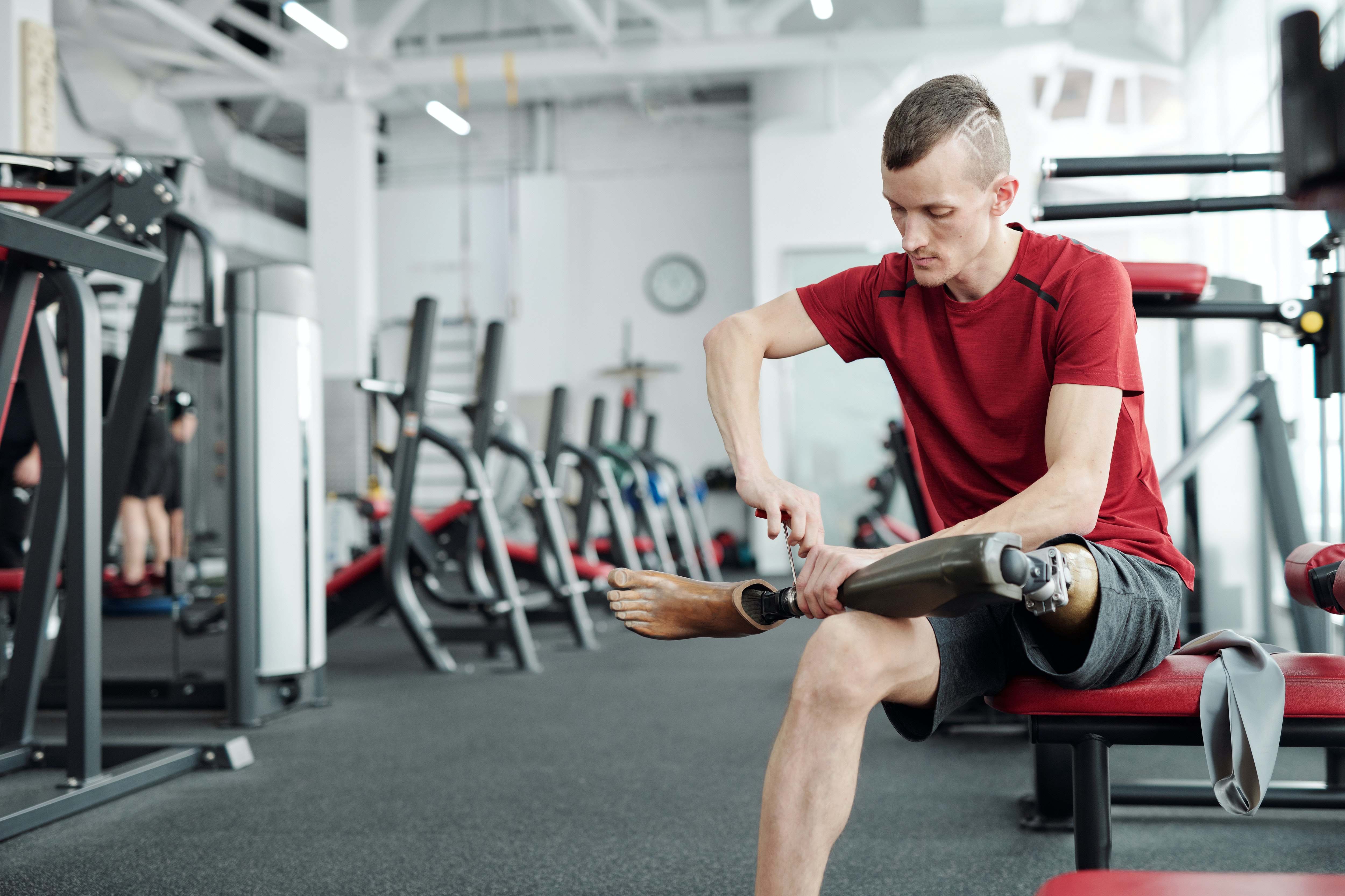 What to Expect After a Below Knee Amputation – Recovery, Prosthetics & Life