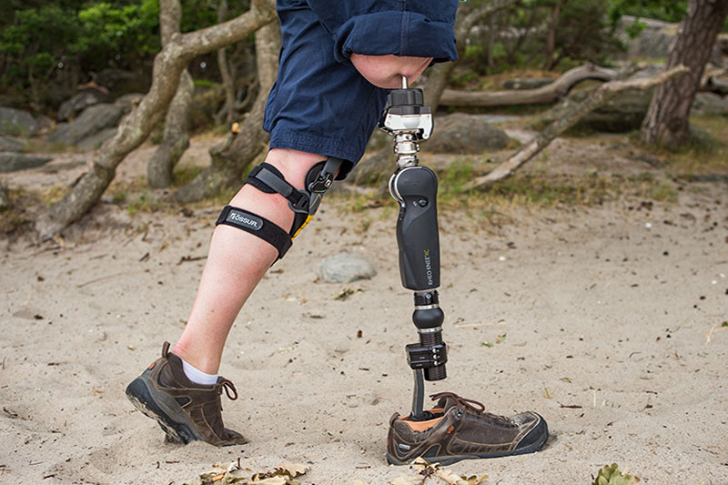 Above knee prosthetic leg — Pro-Ortho Perfect India Thane