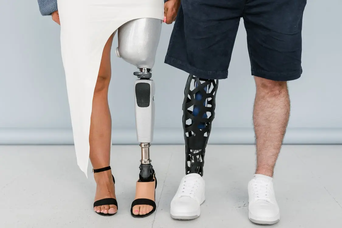 Below Knee vs Above Knee Prosthetics – Key Differences Explained